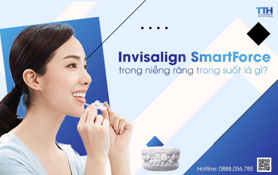 Niềng răng trong suốt tại Nghệ An - Invisalign SmartForce là gì?